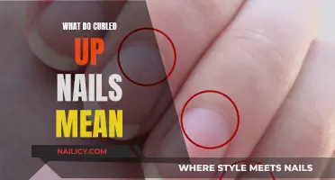 Curled Up Nails: Unraveling the Mystery of This Skin Condition