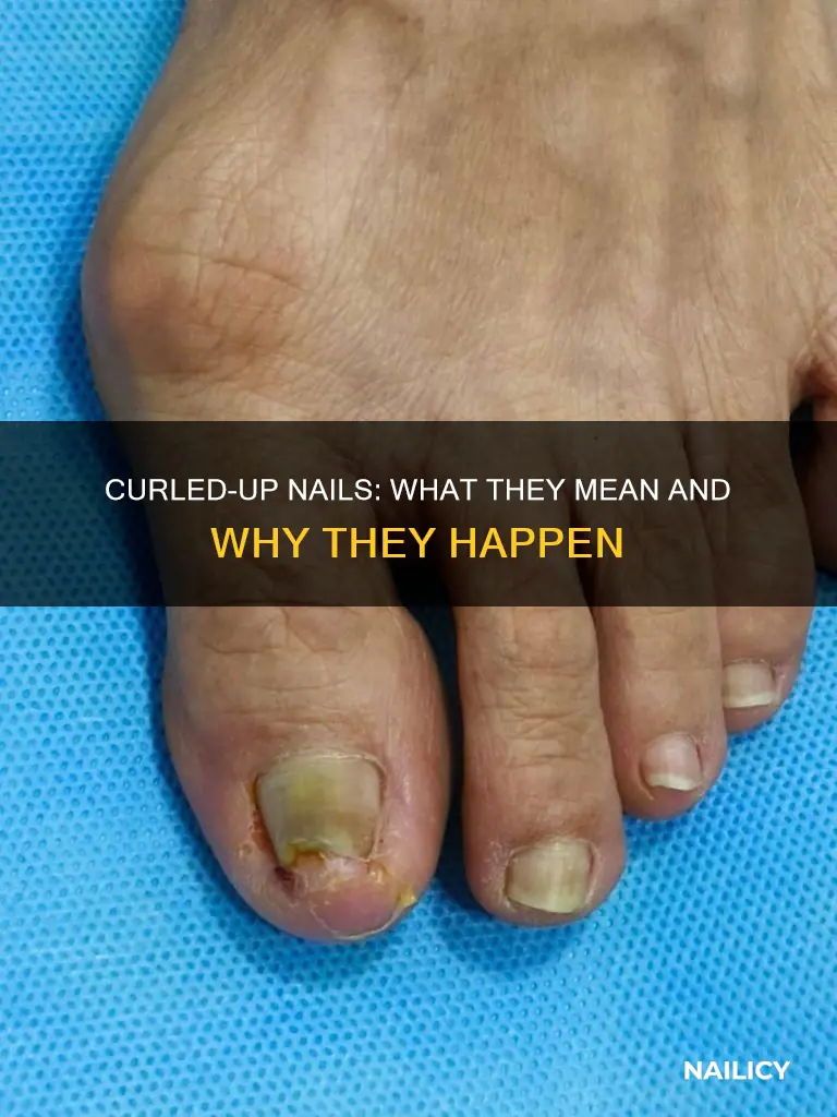 what do curled up nails mean