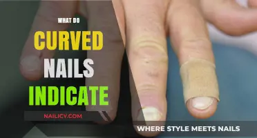 Decoding the Mystery: What Do Curved Nails Really Indicate?