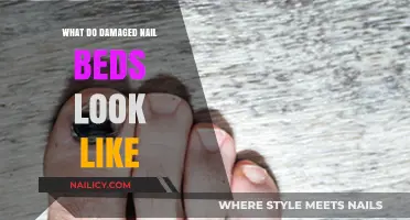 Identifying Damaged Nail Beds: Symptoms, Causes, and Treatment Options