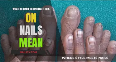 Unraveling the Mystery: Dark Horizontal Lines on Your Nails