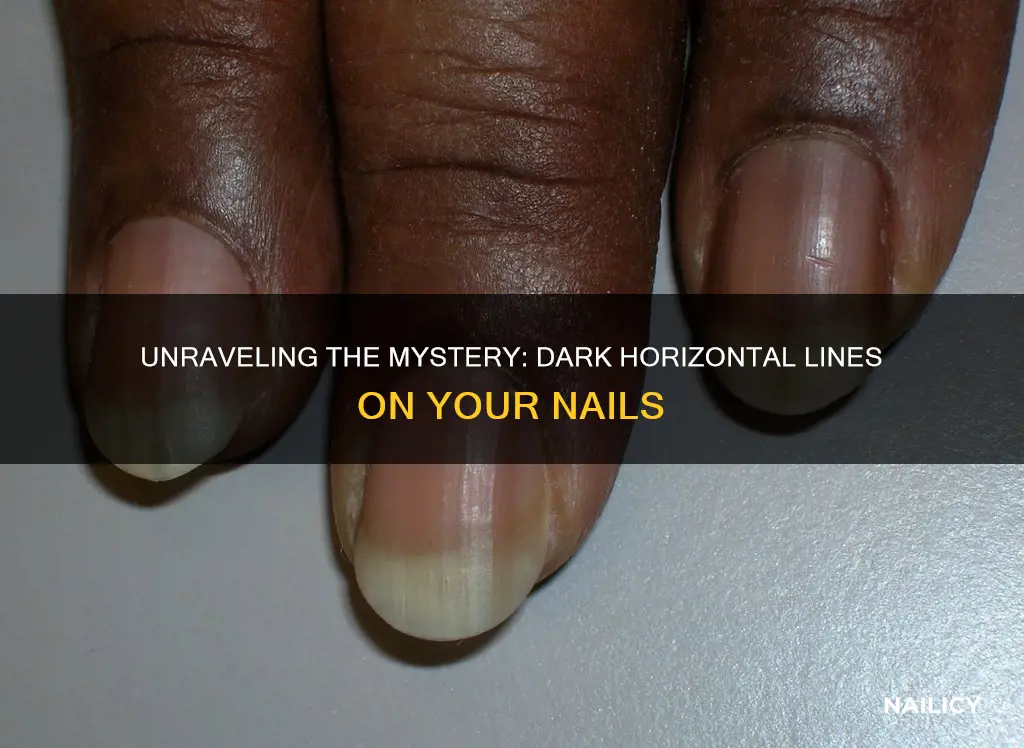 what do dark horizontal lines on nails mean