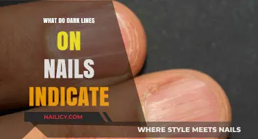 Dark Lines on Nails: Uncovering Hidden Health Clues and Causes