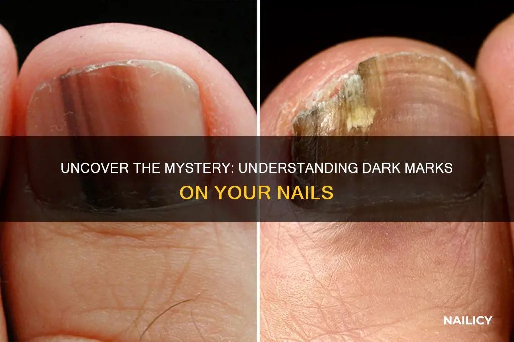 what do dark marks mean on your nails