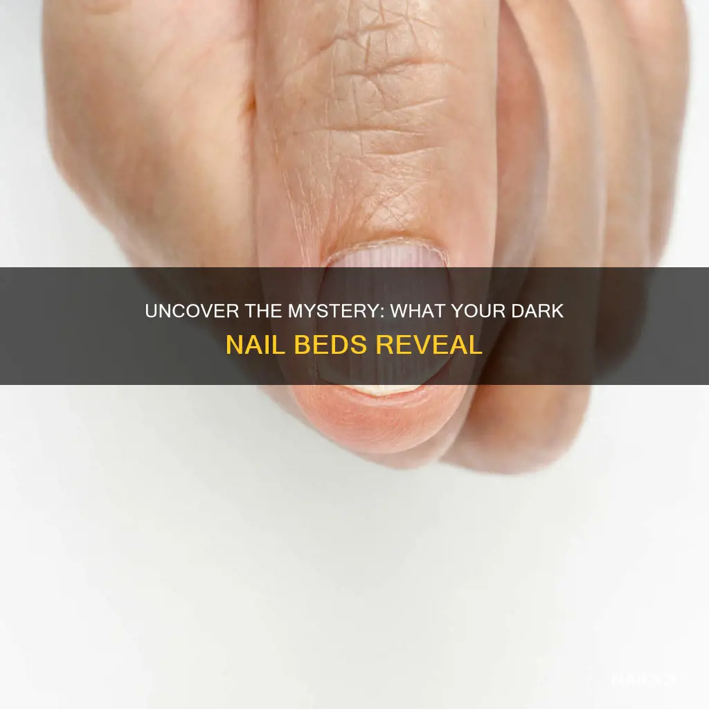 what do dark nail beds mean