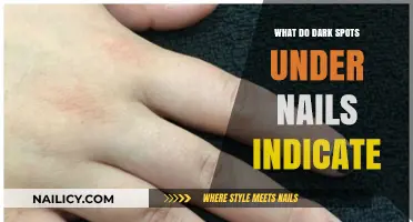 Dark Spots Under Nails: Causes, Concerns, and When to Seek Help