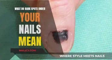 Uncover the Mystery: Dark Spots Under Your Nails