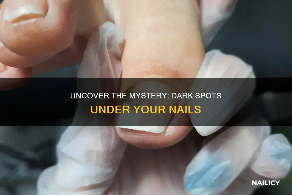 what do dark spots under your nails mean