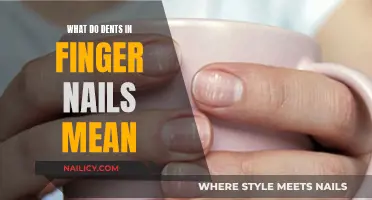 Unraveling the Mystery: What Do Dents in Your Nails Indicate?