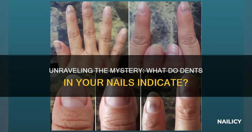 what do dents in finger nails mean