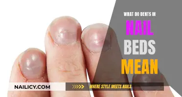 Unraveling the Mystery: What Do Dents in Nail Beds Indicate?