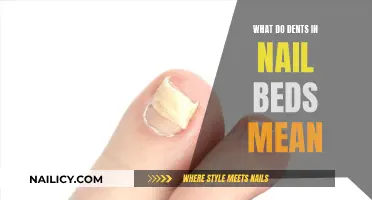 Nail Bed Dents: What Do They Indicate?