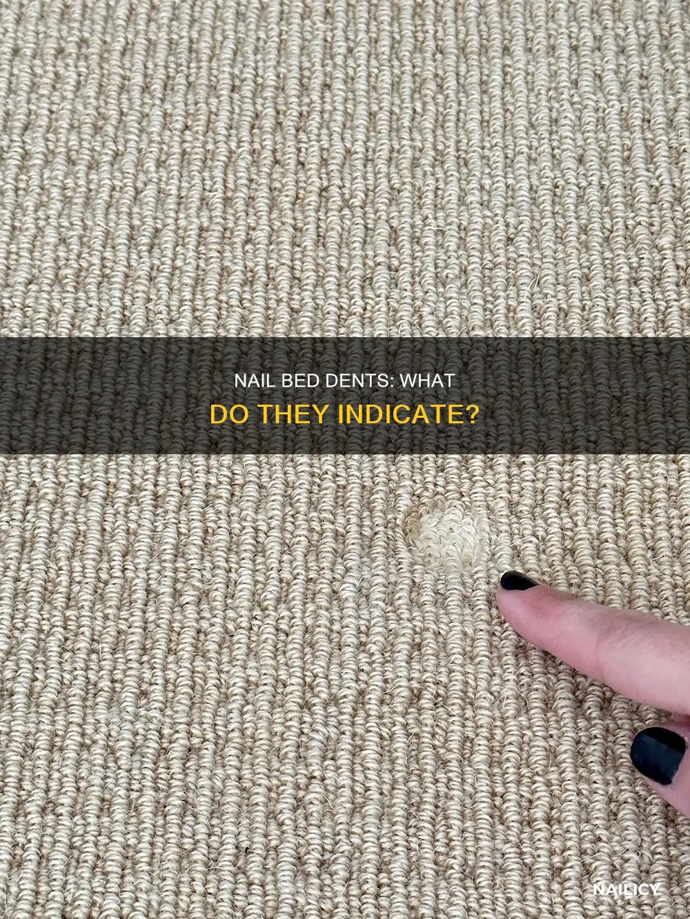 what do dents in nail beds mean