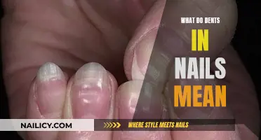 Unraveling the Mystery: What Do Dents in Nails Indicate?