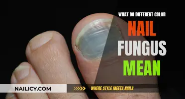 Unraveling the Mystery: What Your Nail Fungus Color Reveals