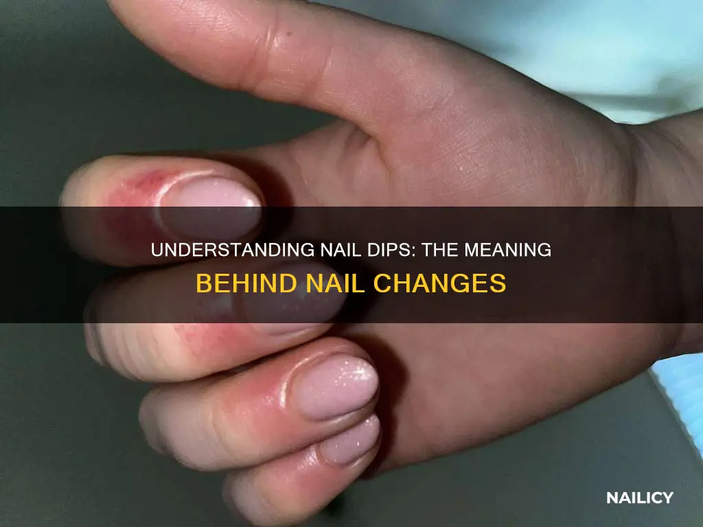 what do dips in nails mean