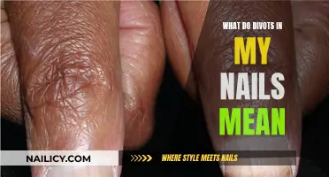 Understanding Nail Divots: What They Mean for Your Health