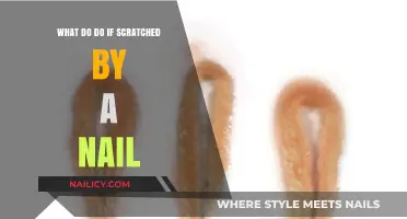 Nail Scratch First Aid: Quick Steps to Treat and Prevent Infection