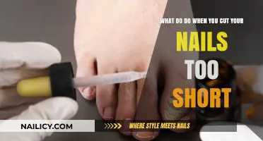 Short Nails: Quick Fixes and Long-Term Solutions