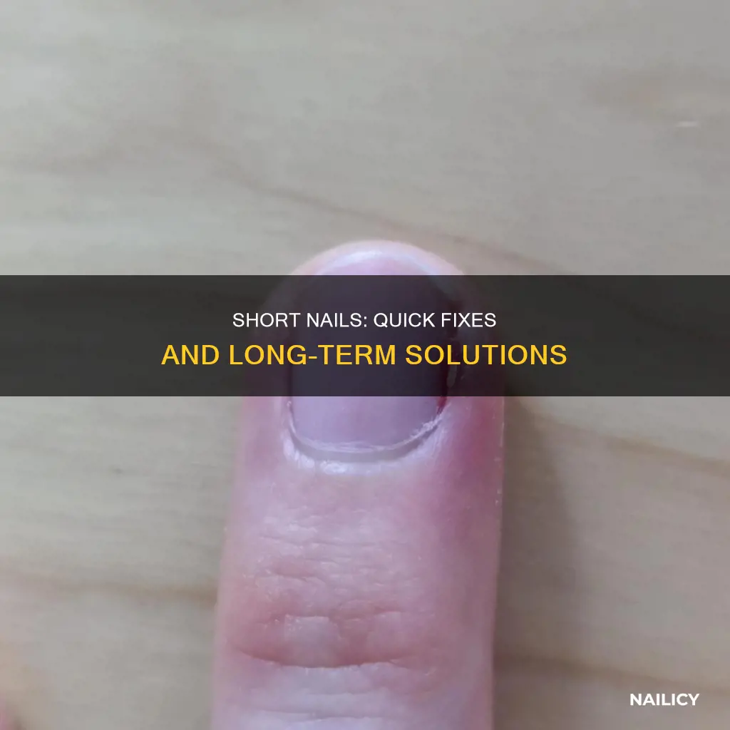 what do do when you cut your nails too short