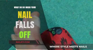 Nail Emergency: Quick Steps to Heal and Protect After a Lost Nail