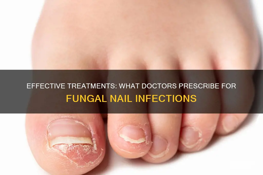 what do doctors prescribe for fungal nail
