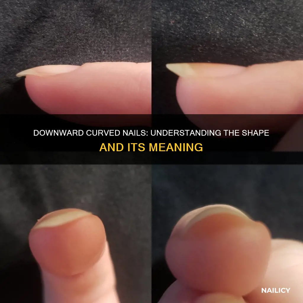 what do downward curved nails mean