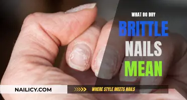 Unraveling the Mystery: Why Your Nails Are Dry and Brittle