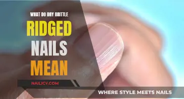 Nail Health: Understanding Dry, Brittle, Ridged Nails