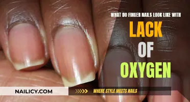 Oxygen-Deprived Nails: A Visual Guide to Understanding the Signs