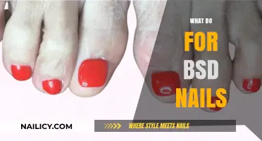 Creative Solutions for Managing and Treating BSD Nails