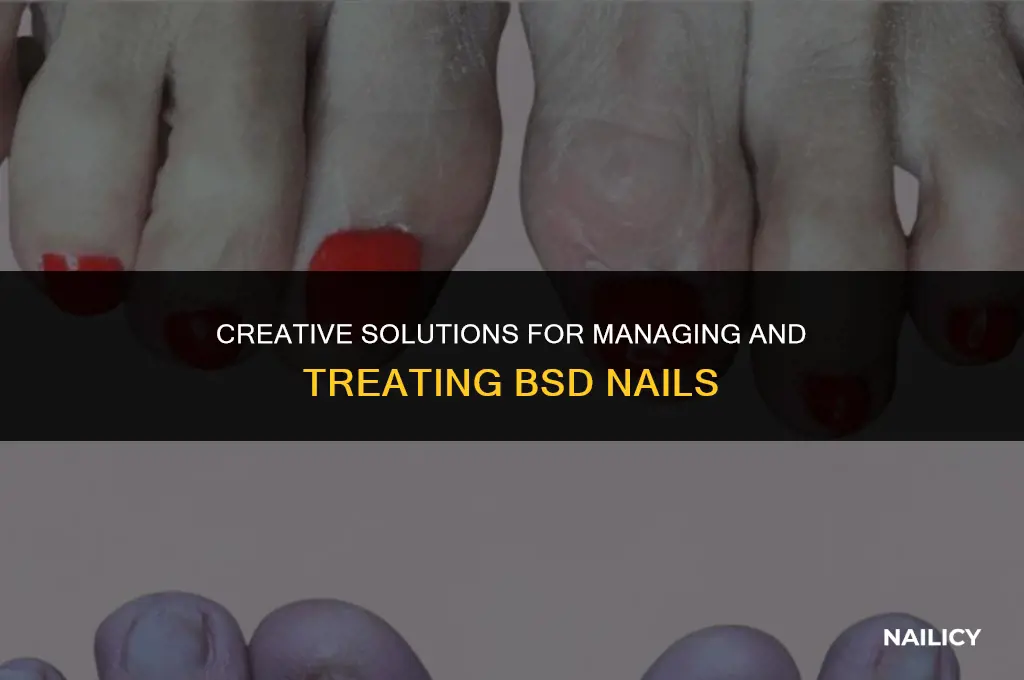 what do for bsd nails