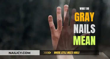 Gray Nails: What's the Underlying Health Concern?
