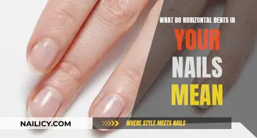 Unraveling the Mystery: Horizontal Dents in Nails