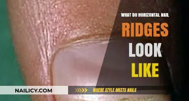 Understanding Horizontal Nail Ridges: Appearance, Causes, and What They Indicate