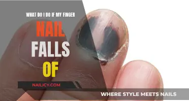 Nail Emergency: Quick Tips for a Torn-Off Fingernail