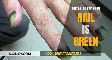 Green Nail Mystery: Causes and Solutions Revealed