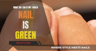 Treating a Green Fingernail: What You Need to Know