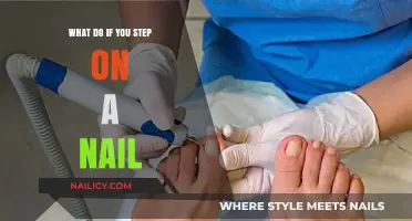 Stepped on a Nail? Immediate Steps to Prevent Infection and Heal