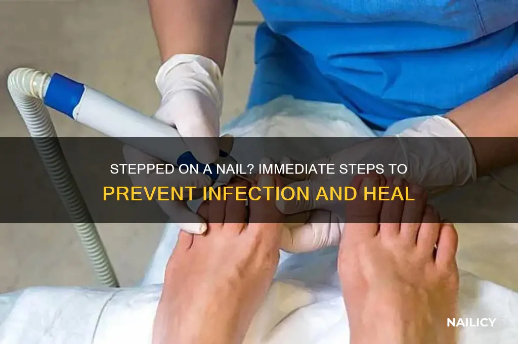 what do if you step on a nail