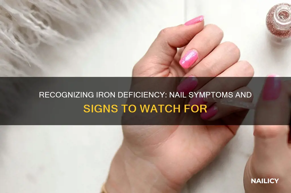 what do iron deficiency nails look like
