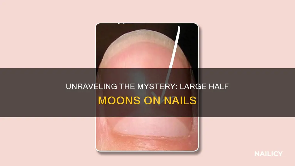 what do large half moons on nails mean