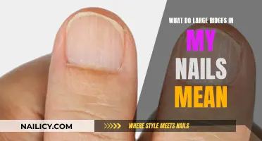 Unraveling the Mystery: Large Ridges in Your Nails