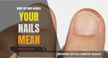 Unraveling the Mystery: What Your Nail Lines Reveal