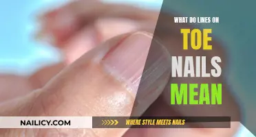 Unraveling Toe Nail Lines: What They Reveal About Your Health