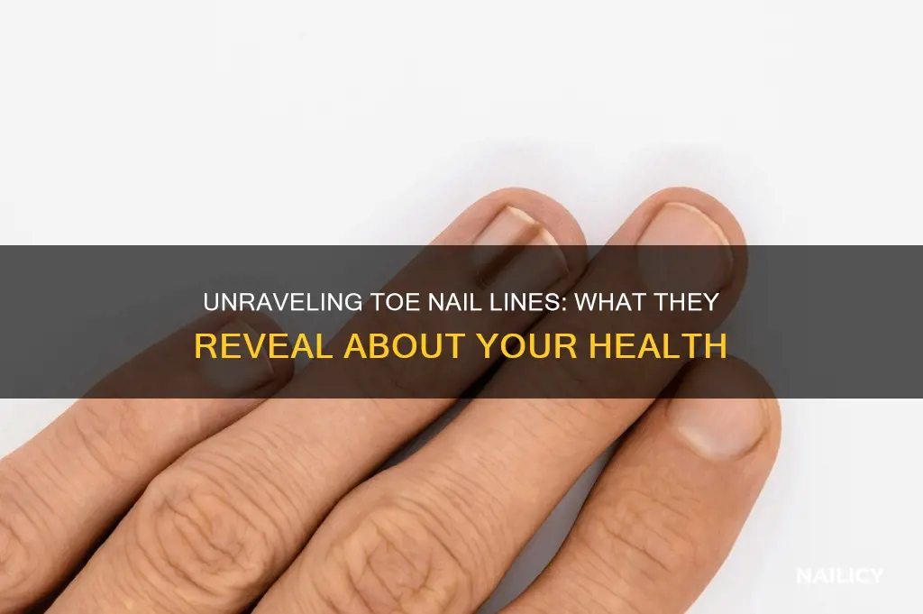 what do lines on toe nails mean