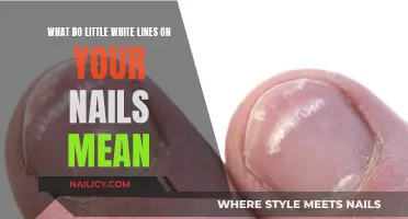 Unraveling the Mystery: Little White Lines on Your Nails