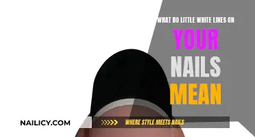 White Lines on Nails: What Do They Indicate?