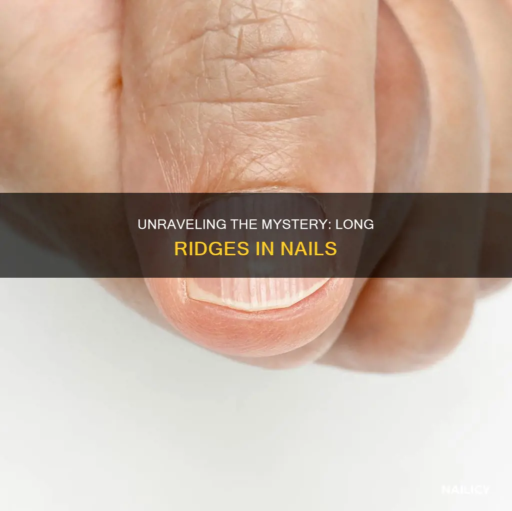 what do long ridges in nails mean