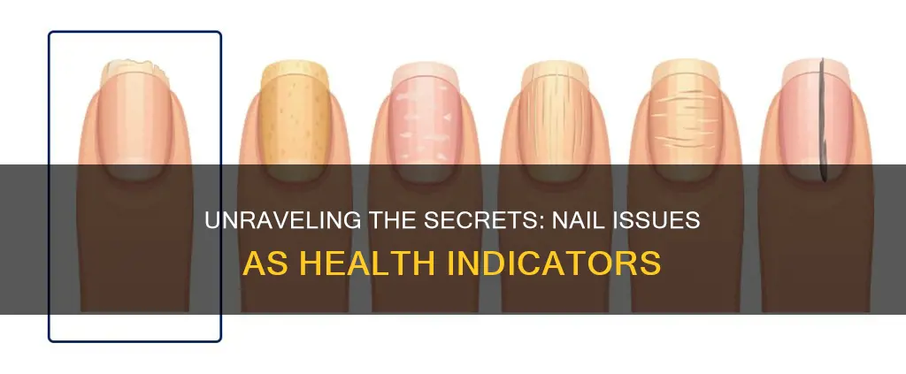 what do nail problems mean